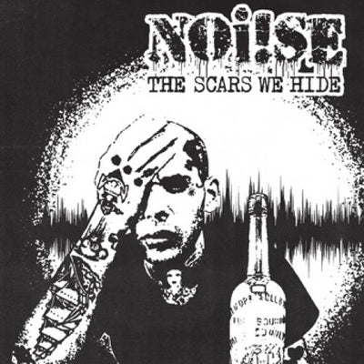 Noi!se "The Scars We Hide"